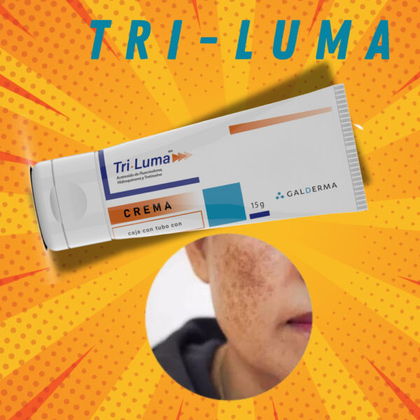 Triluma Crema 15g Fluocinolona, Tretinoína Galderma Generica Neutra Día/noche - Image 3