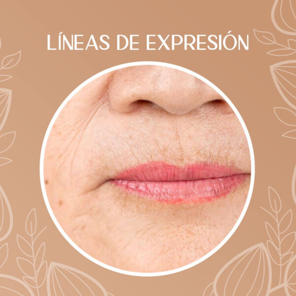 Crema Despigmentante Para Manchas, Melasma, Acné Y Paño - Image 6