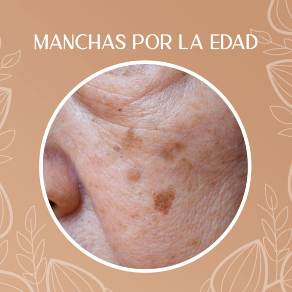 Crema Despigmentante Para Manchas, Melasma, Acné Y Paño - Image 5