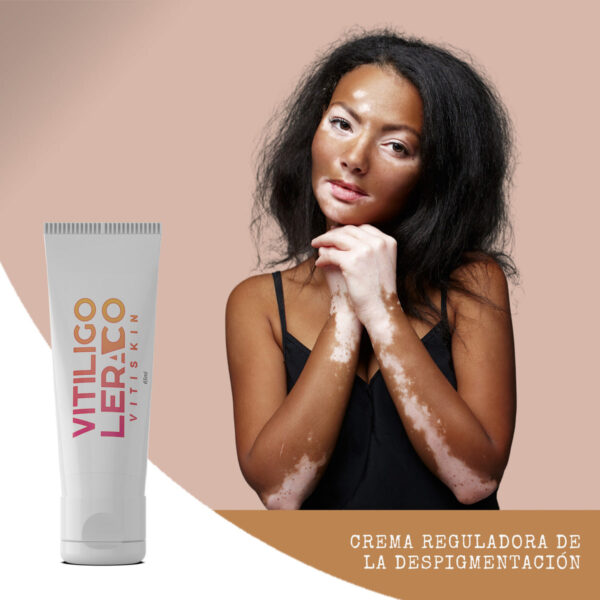 Loción Y Crema Vitiligo Oleraco Corporal  Efectiva - Image 3